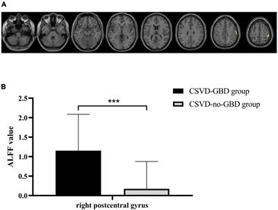 Altered neuroimaging patterns of cerebellum and cognition underlying the gait and balance dysfunction in cerebral small vessel disease
